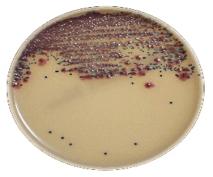 Chromogenic media for bovine mastitis KESC organisms