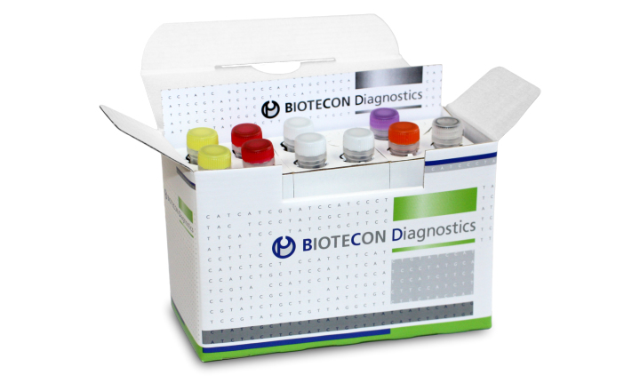 Multiplex real-time-RT-PCR test for virus detection in food and bottled water