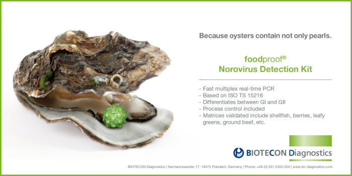 Norovirus real-time PCR kit