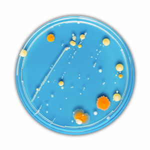 Microbial Identification & Strain Typing