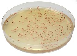 Chromogenic media for Campylobacter