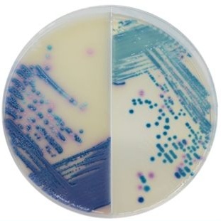 Chromogenic media for mastitis organisms