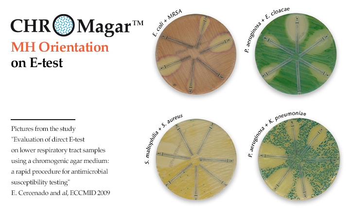 MH Orientation Agar for VAP