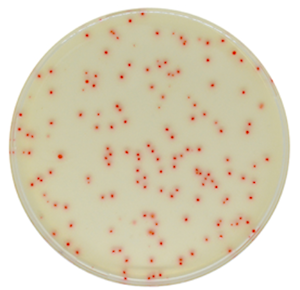 Chromogenic media for Clostridium perfringens