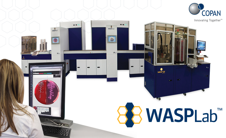 WASP®DT: Walk-Away Specimen Processor