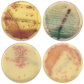 Automatic MRSA reading on chromogenic media