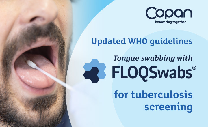 WHO Validates Tongue Swabbing for TB Testing: FLOQSwabs Led the Way &nbsp;