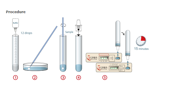 Detect 5 carbapenemase phenotypes with immunoassay