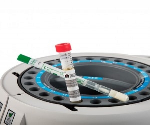 Rapid Microbial Testing of Surfaces
