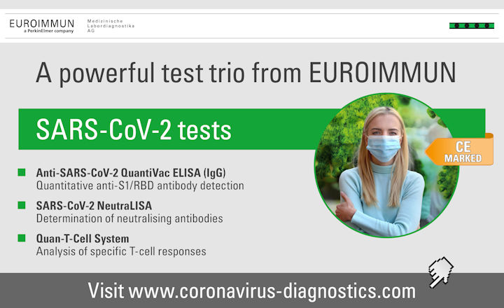 SARS-CoV-2 Immunity testing