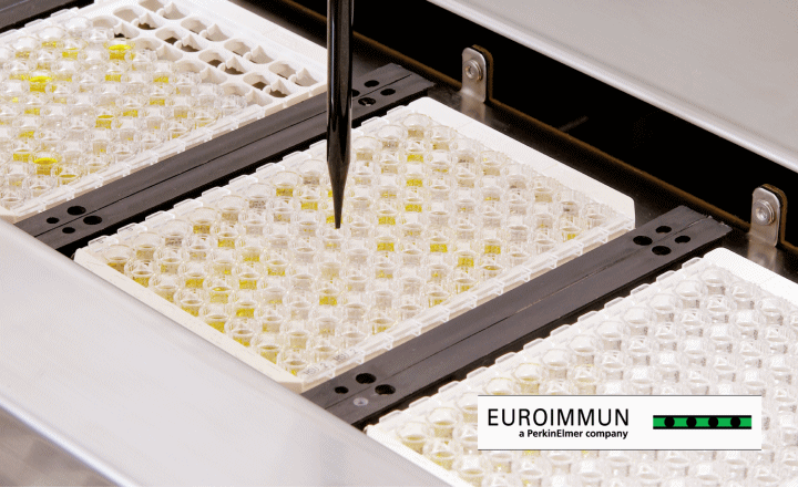 Antigen ELISA test for SARS-CoV-2