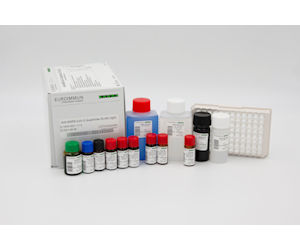 Anti-SARS-CoV-2 QuantiVac ELISA IgG