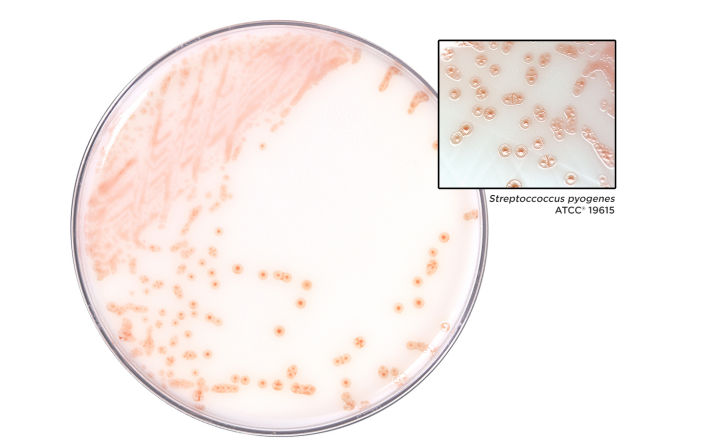 Colored Strep A colonies on a HardyCHROM chromogenic agar