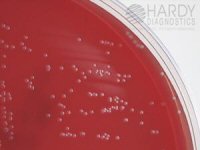 Arcanobacterium haemolyticum