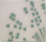 Vibrio parahaemolyticus teal colour