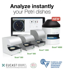 Automated Petri Dish reader for food microbiology