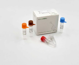 Influenza A and B Viruses Real Time PCR