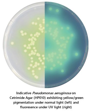 Harmonised Pharmacopoeia Culture Media