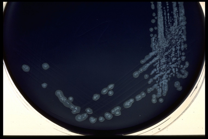 Campylobacter Blood Free Selective Medium Modified CCDA 