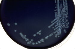 Campylobacter Culture from Lab M