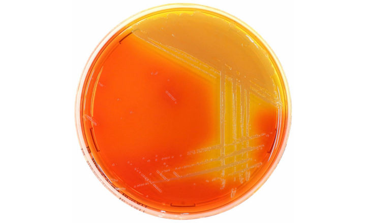 Chromogenic media for Burkholderia cepacia complex