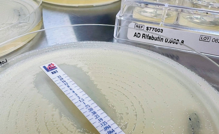 New Agents and Devices for Antimicrobial Susceptibility Testing on Show at ESCMID 2026