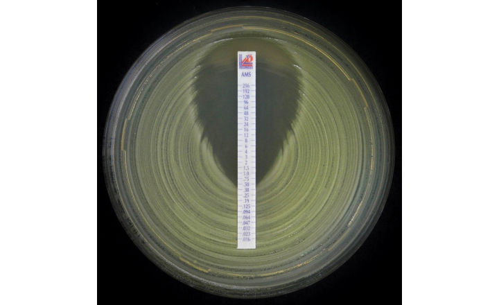 contour next test strips