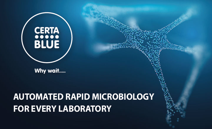 Automated rapid microbiology for every laboratory