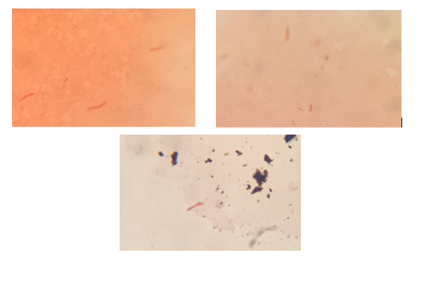 Gram Films from non-compliant transport swabs - medium, plain and charcoal