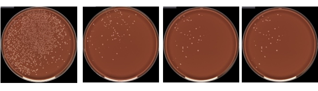 Comparion of recovery of Neisseria gonorrhoeae from different transport swabs