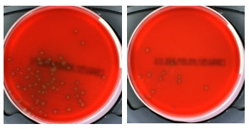 Comparison of recovery of Strep pneumoniae from different transport swabs