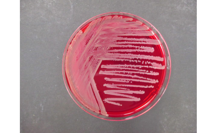 Culture on selective agar