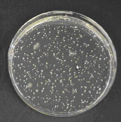 New TOS MUP Medium for Enumeration of Bifidobacteria