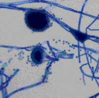 Detection of Fungi using Stains/Staining Reactions