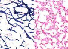 Gram staining kit