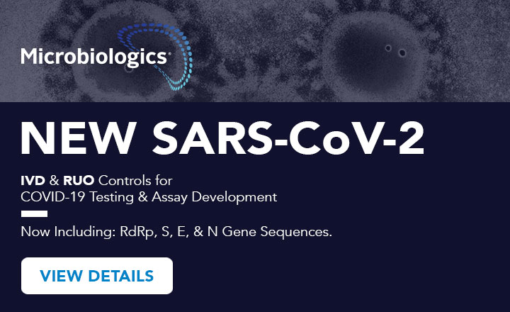 SARS-CoV-2 IVD and RUO Controls