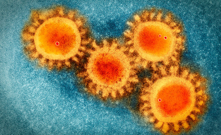 Microbiologics Corona Controls