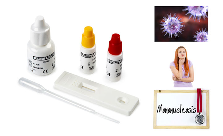 Microgen Bioproducts Launch PathFlow Mononucleosis