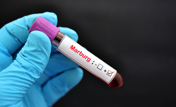 Field Marburg Virus Testing