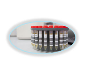 GreenLight Sensor Vials