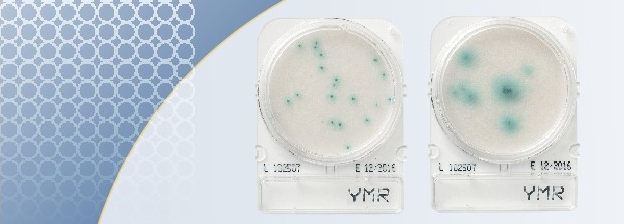 Easiest yeast and mold counts