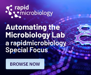 special focus on how to automate the microbiology lab