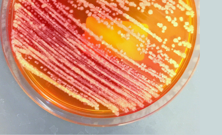 Enterobacteriaceae on plate