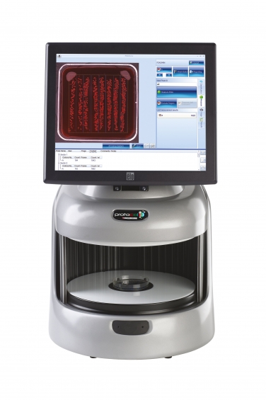 automated counting of sba