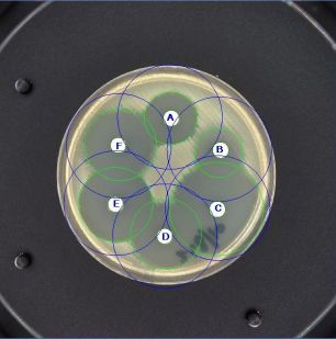 Software Automatically Analyses AST Plates to Give SIR Category