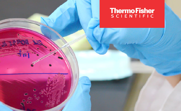 A close up of colonies on a pink agar plate