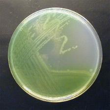 New Thermo Scientific Medium Enhances the Identification of em Pseudomonas aeruginosa em