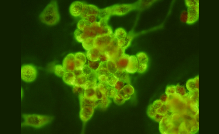 High affinity antibody pairs Omicron