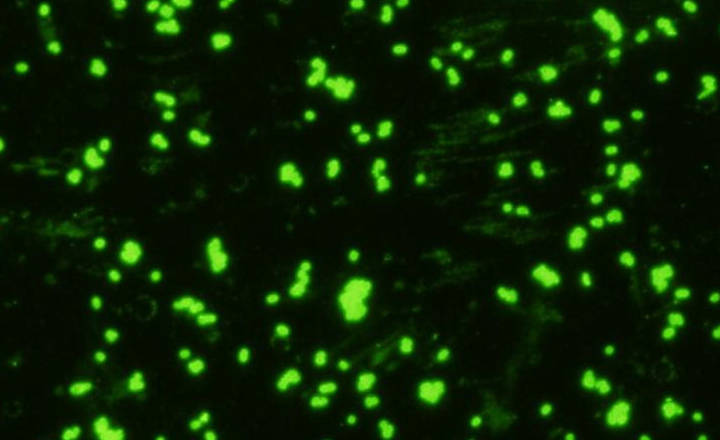 Antibodies for immunassay development Gram negative bacteria