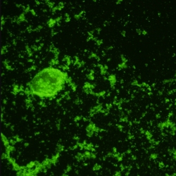 Entamoeba histolytica antibodies